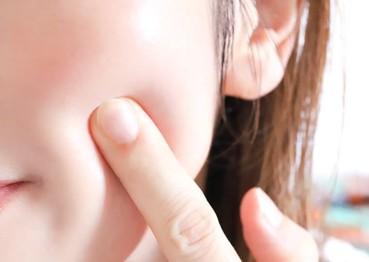 美肌