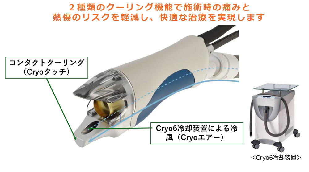 2種類のクーリング機能で施術時の痛みとやけどのリスクを軽減します