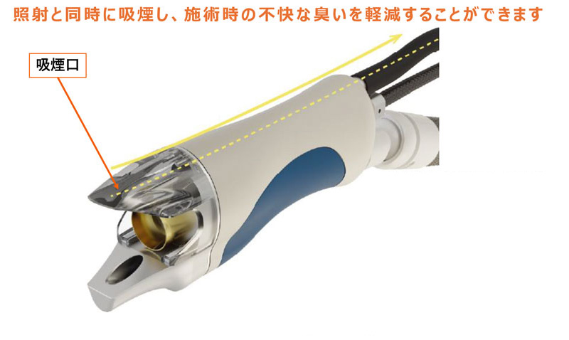 吸煙口があり、照射と同時に吸煙し、不快な臭いを軽減することができます