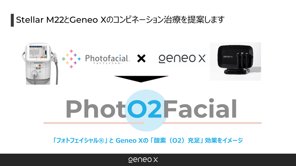 フォト2フェイシャルで用いる機器の画像