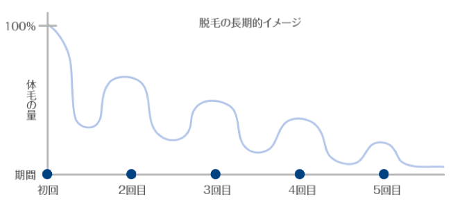 脱毛の長期的イメージ