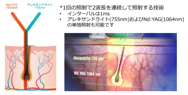 波長の特徴