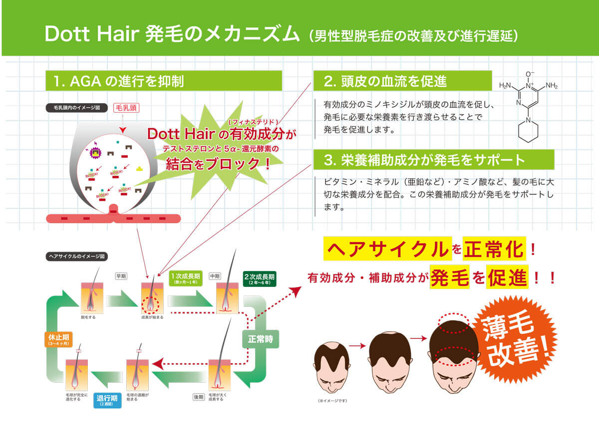 男性の薄毛のメカニズム