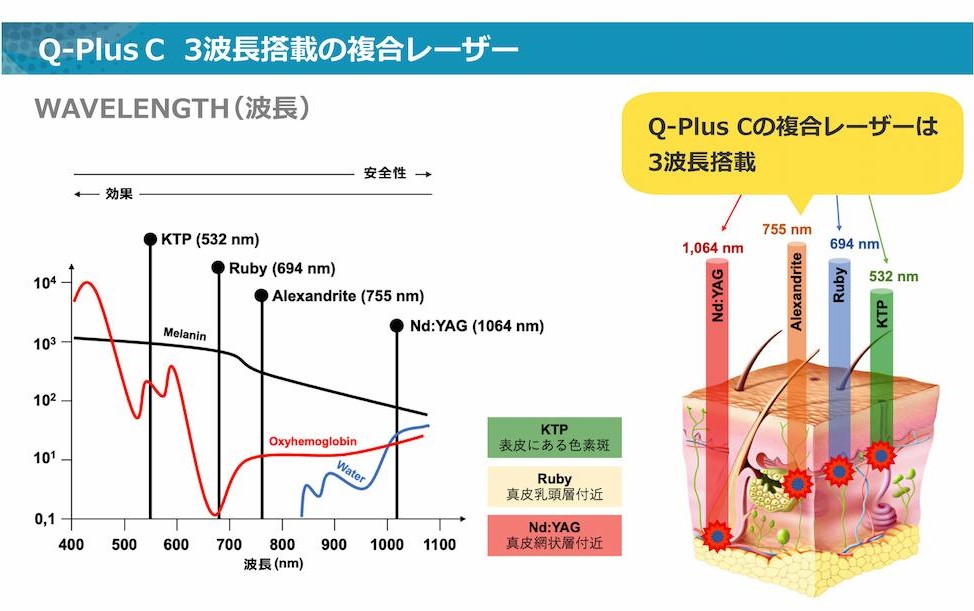 Q-Plus C 3波長搭載の複合レーザー