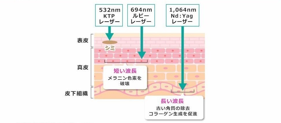 Q-Plus C 3波長搭載の複合レーザー